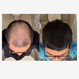 Growth - Hair Care Set