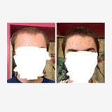 Growth - Hair Care Set